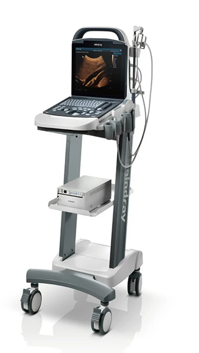 Mindray DP-10 Ultrasound Machine Of New Generation Doppler Ultrasound System