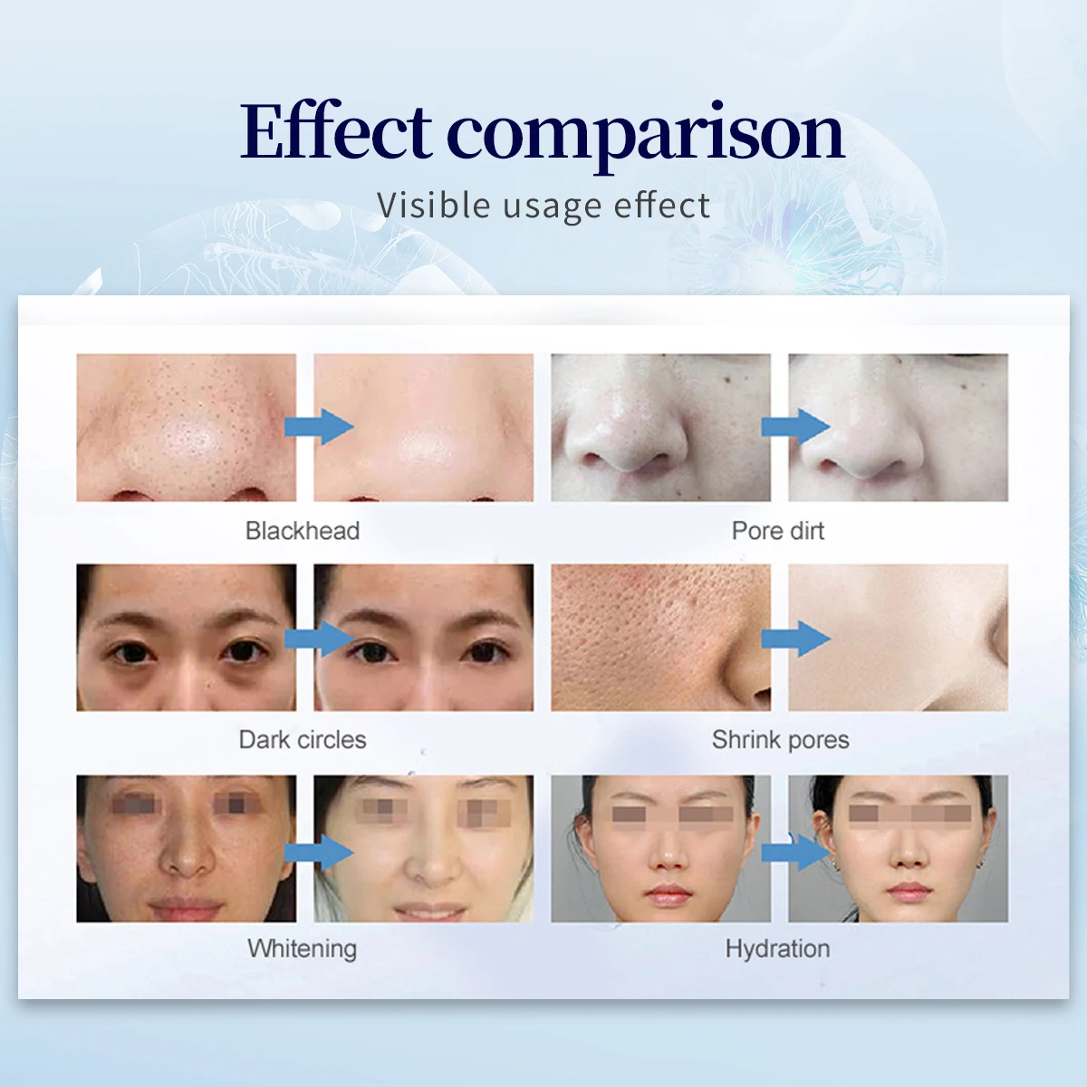 2025 7 in 1 Smart Ice Blue Facial Treatment Machine Professional Portable Dermabrasion