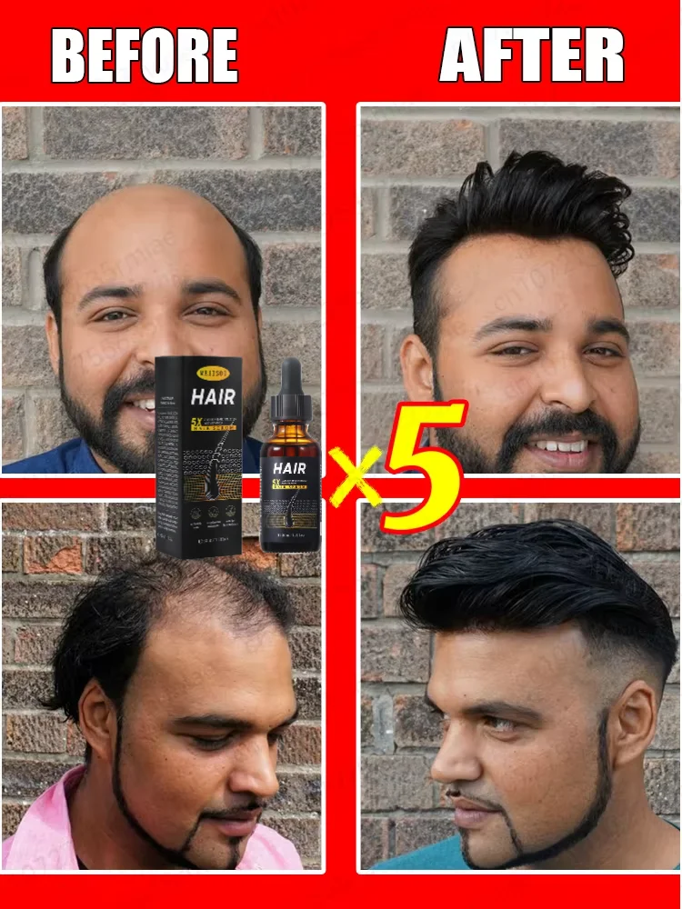 سدادة تخفيف الشعر، تقلل من الكسر بشكل قوي ويغرق المناطق الرقيقة، ويستعيد الشعر السميك والقوي #2