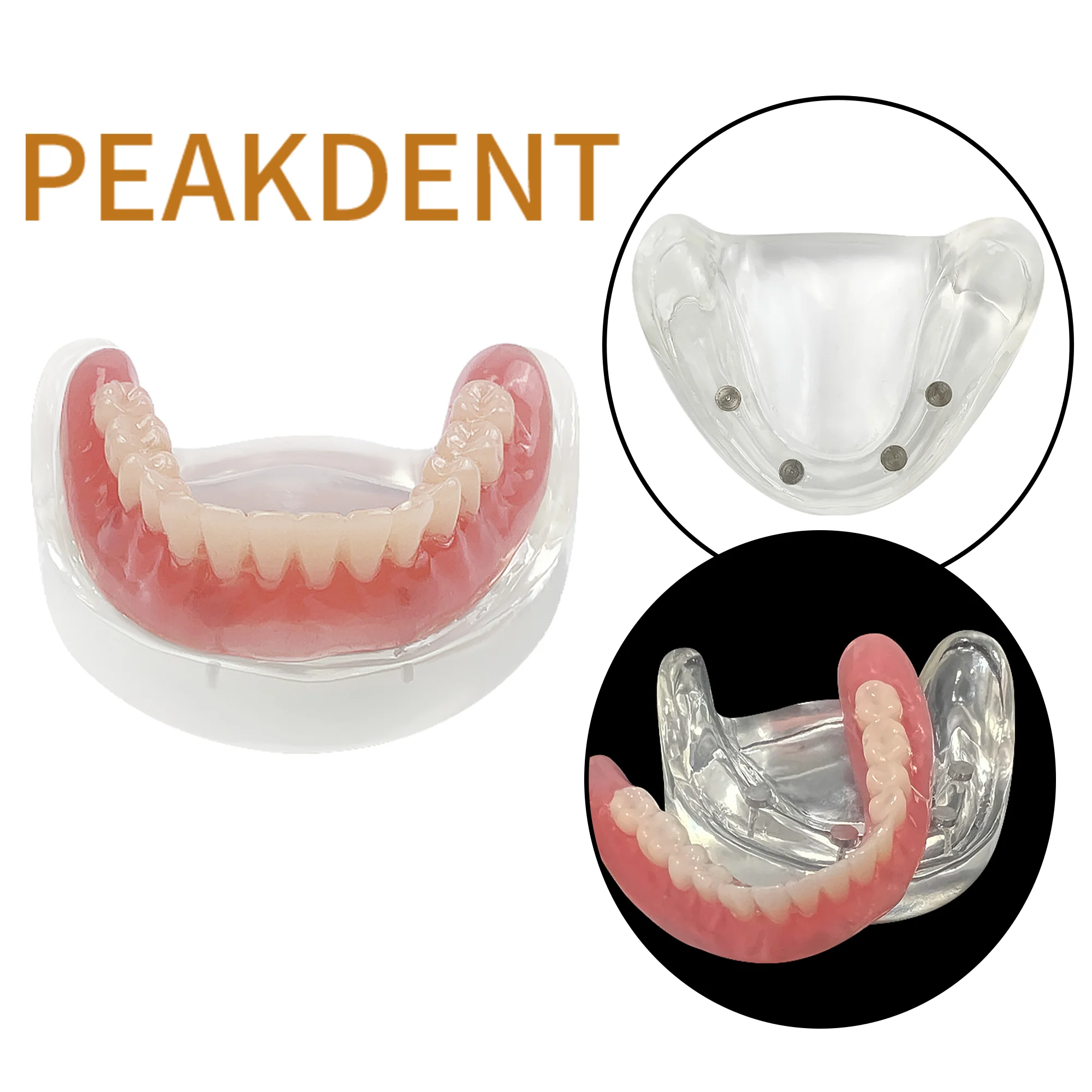 Dental Overdenture Magnetic Lower Teeth Model Inferior Restoration Treatment model Dental Technician Studying Teaching