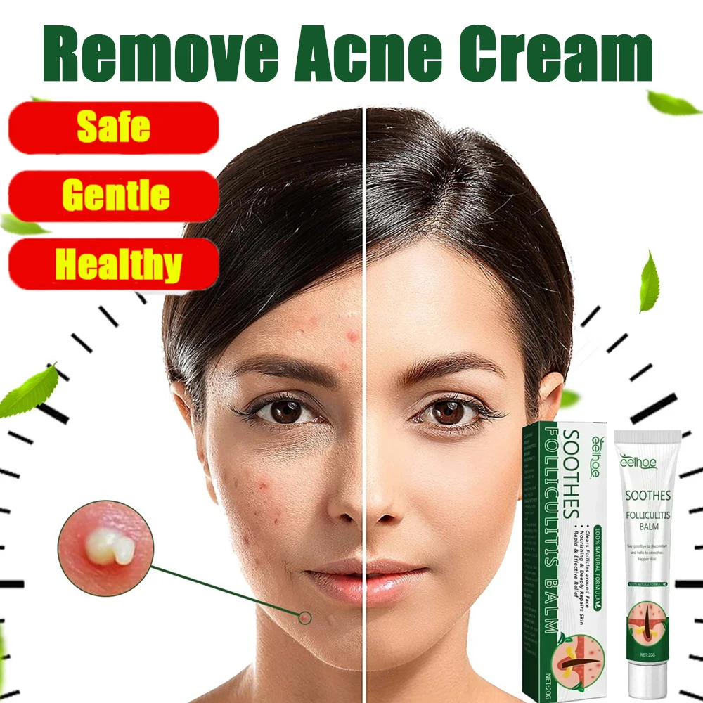 

Acne Remover Face Cream with Pimple Remover, Shrink Pores, Oil Control Skin Care