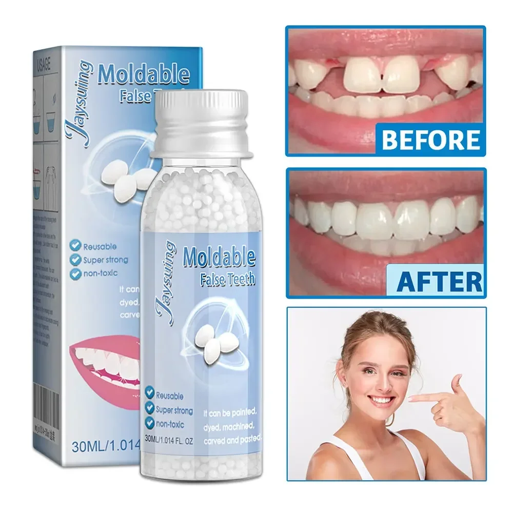 30ml Resin Temporary Tooth Repair Granules Teeth Gaps Missing Broken Tooth False Teeth Filling Moldable Solid Care Products