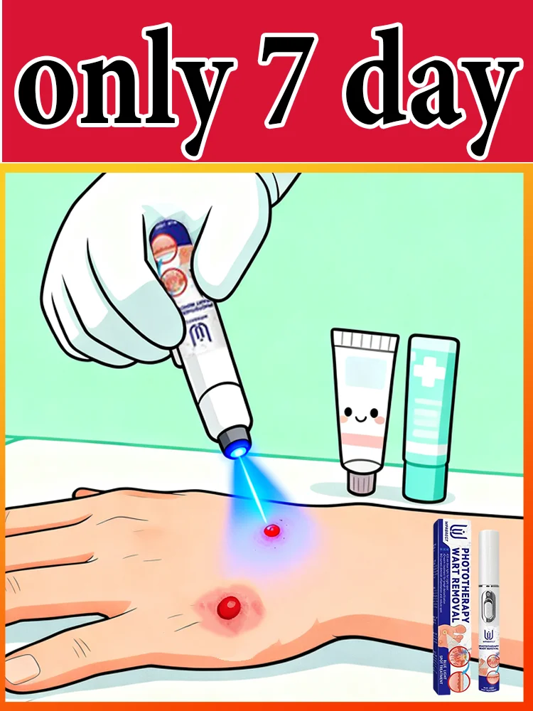 

ʙʟᴜᴇ ʟɪɢʜᴛ ᴘᴇɴ sᴏʟᴠᴇ ᴡᴀʀᴛs, ʜᴏᴛ sᴀʟᴇ ᴡᴀʀᴛ ᴄᴀʀᴇ ᴛᴏᴏʟs