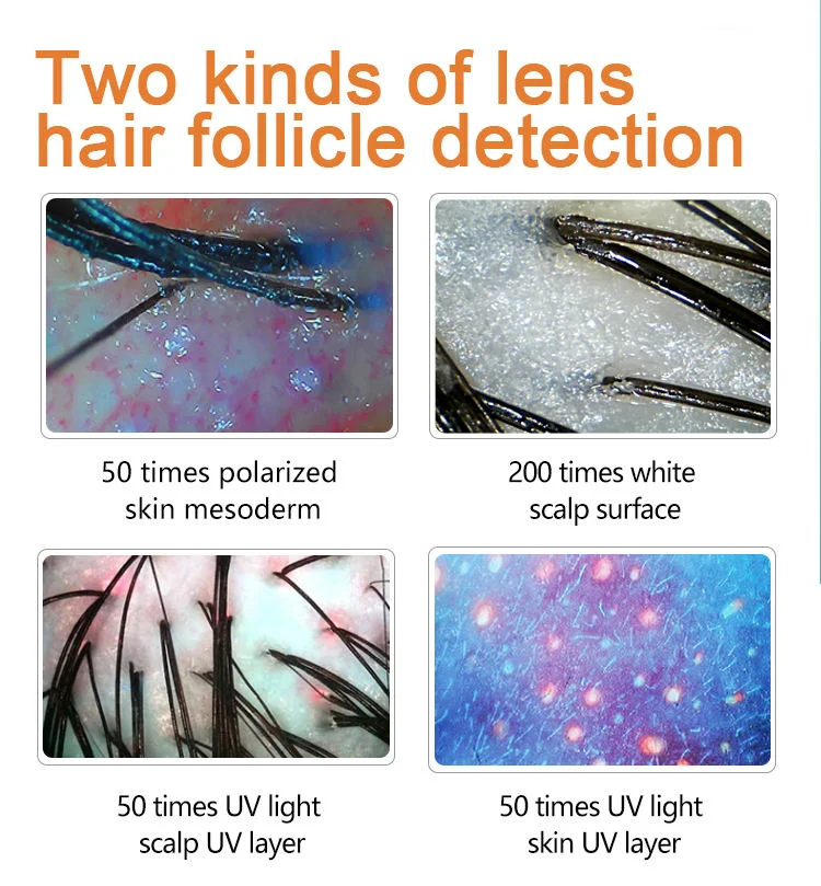 Portable High Quality Intelligent Hair Follicle Scanner Portable Skin Detector Beauty Skin Diagnosis Hair Analyzer Machine