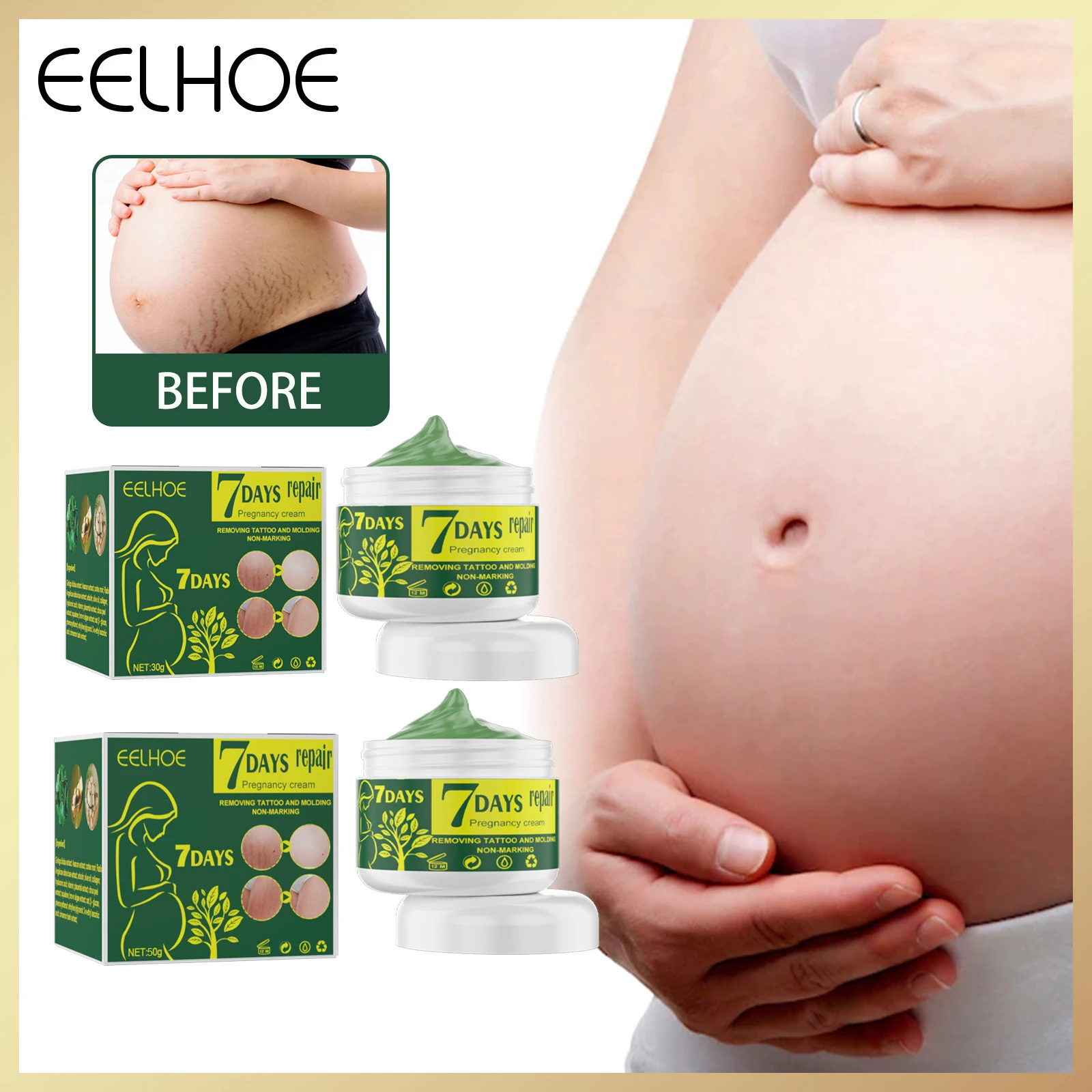 EELHOE Pregnancy Repair Cream To Remove Stretch Marks Scarring Emulsion Stretch Marks Treatment Ointment