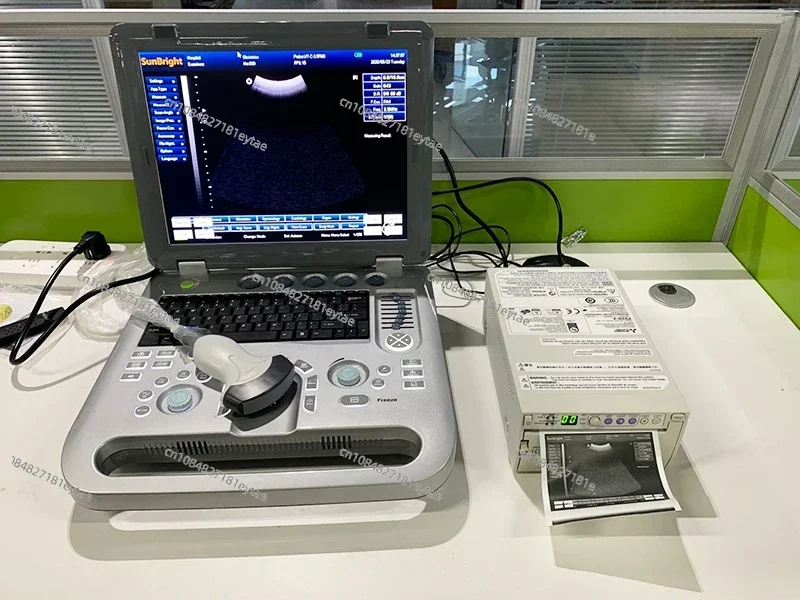 digital portable 3D ultrasound machine with echograph ultrasound system and echocardiography price