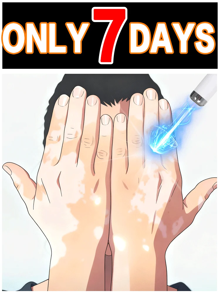 

Quickly remove vitiligo and restore skin health