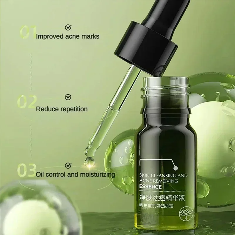 Effective Acne Removal Comfortable Acne-removing Liquid Improve Acne Convenient Facial Repair Solution Skin Care Products Gentle