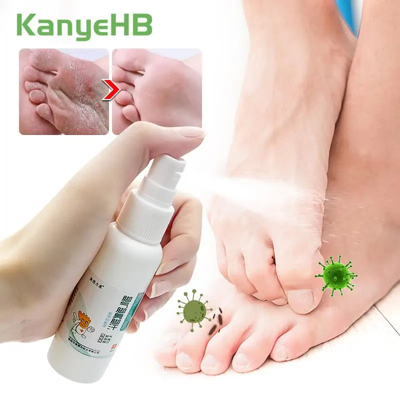 

2pcs Chinese Beriberi Ointment Inhibit Fungi Remove Odor Repair Foot Skin Athlete's Foot Treatment Cream Tinea Pedis Spray A1130