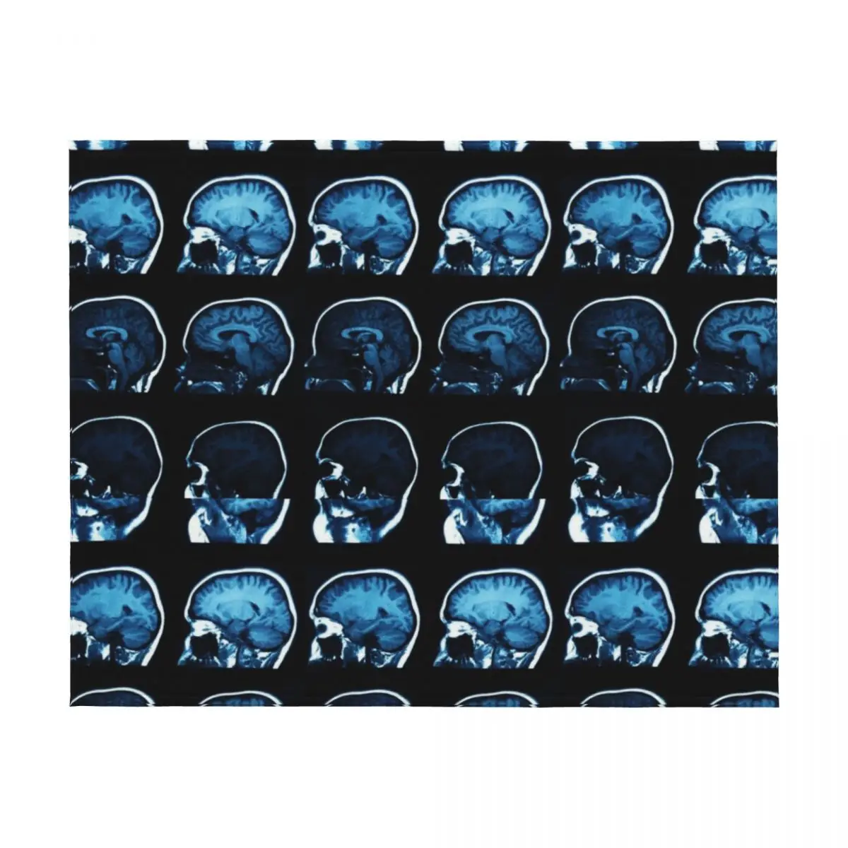 الدماغ MRI الأشعة السينية رمي بطانية البطانيات أرائك الديكور الأربعاء فروي أشعث البطانيات #2