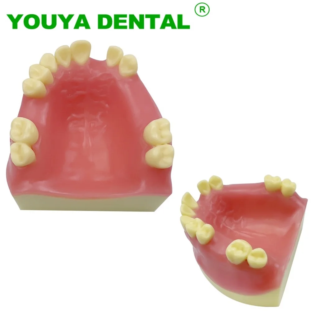 Dental Implant Training Model Soft Gum Teeth Practice Model For Dentist Student Studying Teaching Demonstration Tools Dentistry