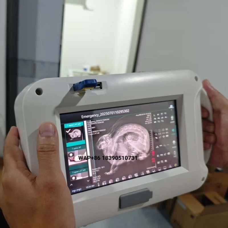 Portable handheld digital X-ray machine with built-in PC for imaging of human chest limbs and veterinary animals