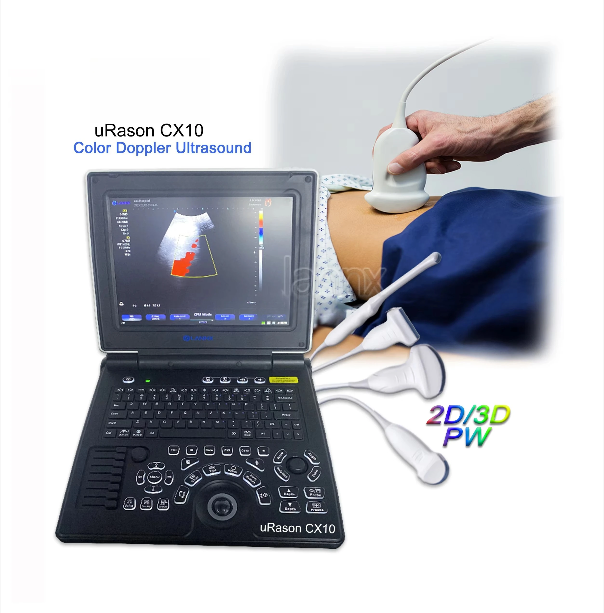 URason CX10 Venda quente Ecografo Portatil Scanner Médico Portátil Ultrassom Humano