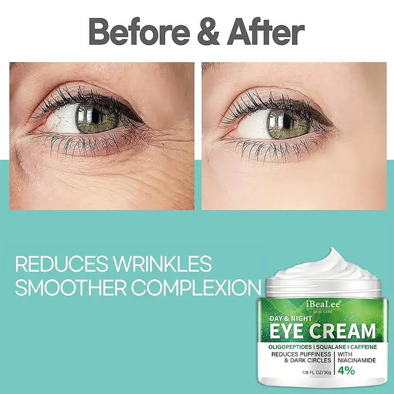 Crème anti-déformante pour les yeux, soin raffermissant pour les poches sous les yeux, les poches, les ridules, les particules de graisse