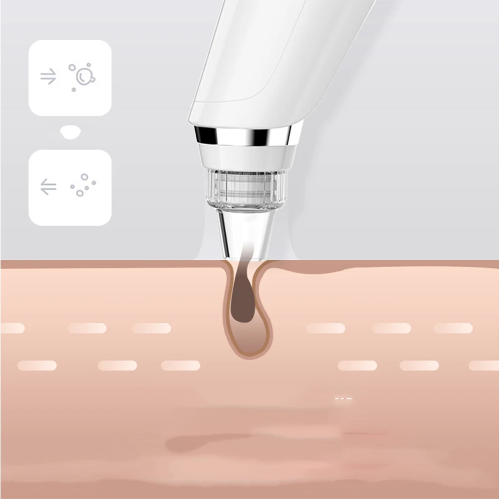 

Electric Blackhead Suction Device Skin Care Instrument Beauty Facial Cleaner Pore Remover