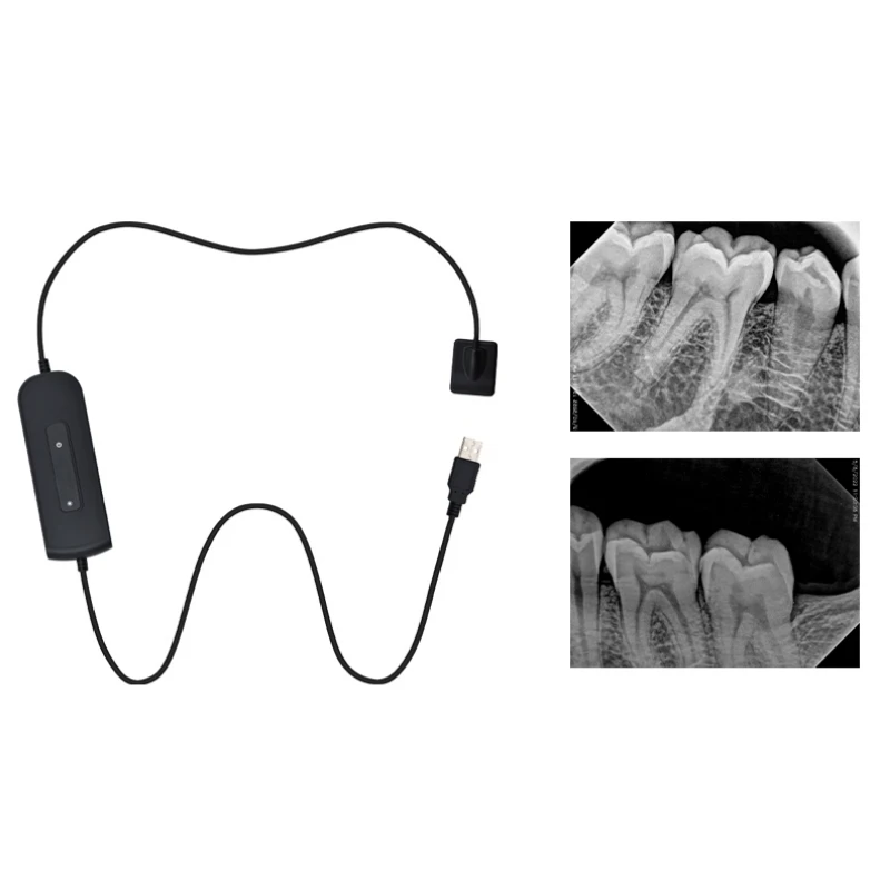 Dental X-Ray Digital Sensor Intraoral Digital Imaging System with Holders 2 Size Options