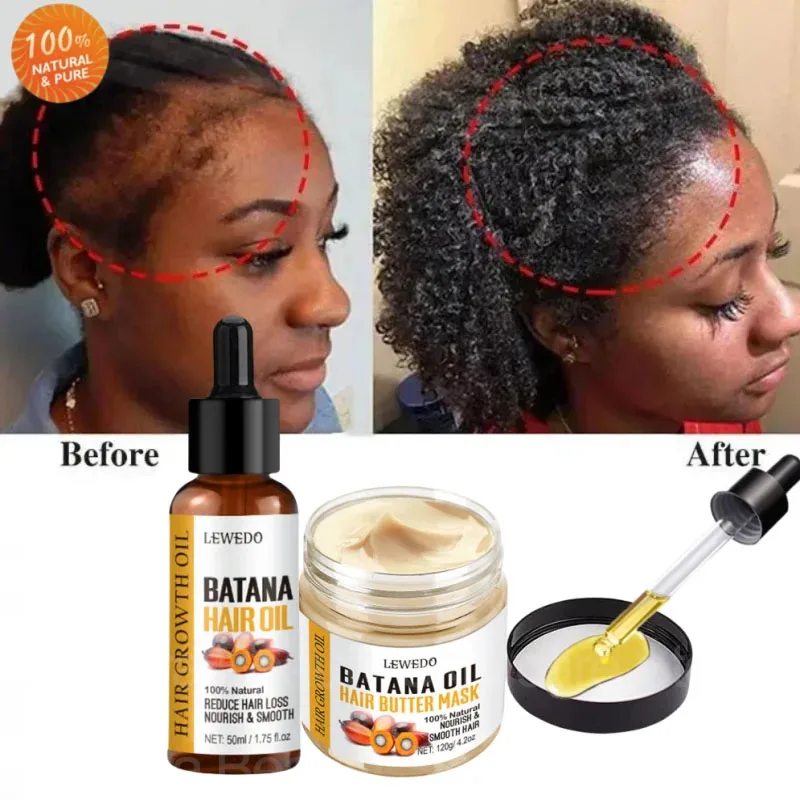 

100% Pure Batana Oil Fast Hair Growth Set African Crazy Traction Alopecia Regrowth Hair Anti Break Hair Loss Treatment Hair Care