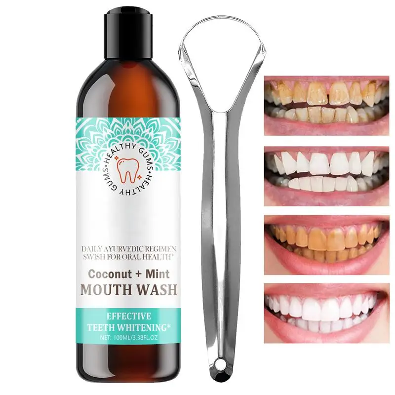 

100ml Fresh Coconut Oil Mouthwash 100ml Mintt Coconut Mouthwash Coconut-Infused Natural Mouthwash Long-Lasting Rinse With Tongue