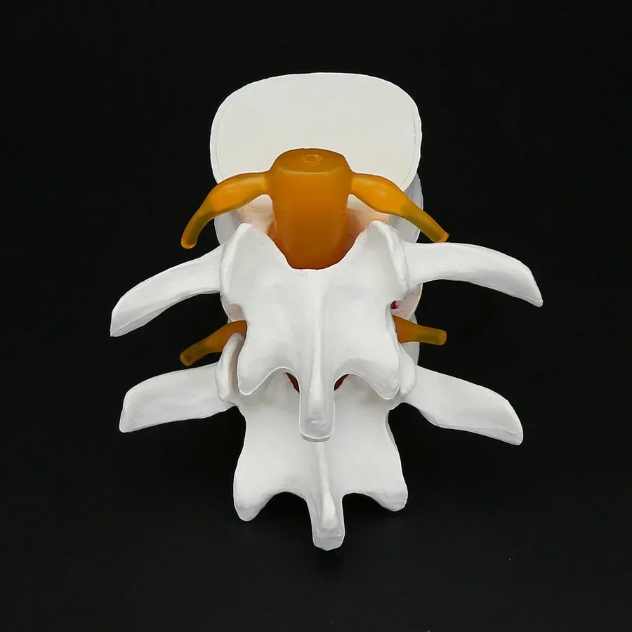 1Piece PVC Hand-Made Lumbar Vertebrae Model Auxiliary Teaching And Demonstration Tool