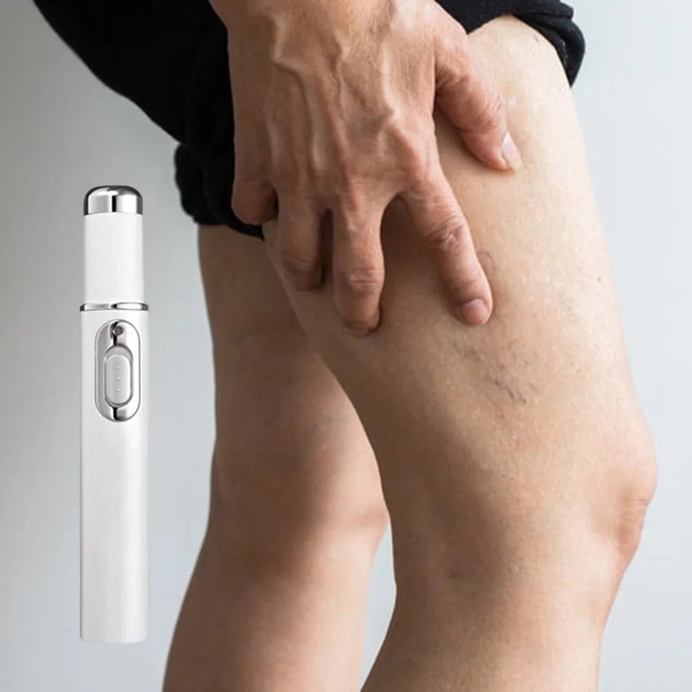 

Varicose Vein Laser Pen for repairing leg spider inflammation and relieving varicose veins in the lower limbs