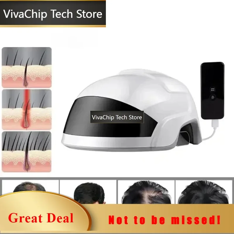 VivaCTWholesale 650nm In-frared Laser LLLT Hair Growth Device Laser Scalp Hair Growth Helmet Hair Growth