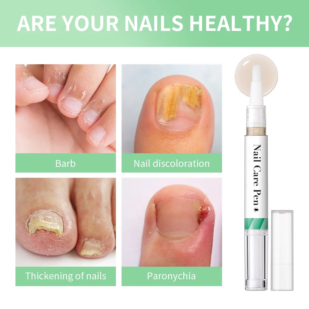 Nail Care Polish Mild Ingredients Prevent Damaged Nail Bed Treat Onychomycosis Nail Repair Pen For Nail Beauty Health Care Tools