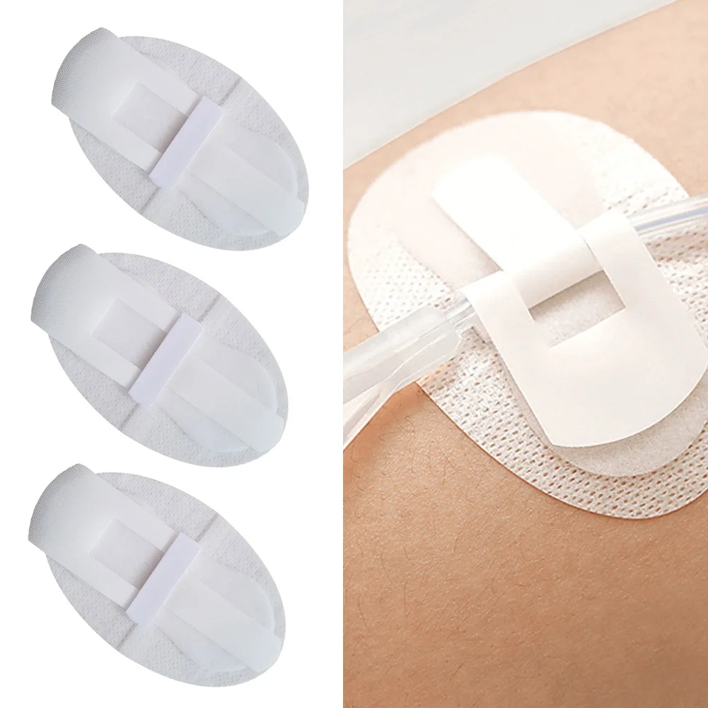 

10 шт., держатель трубки для медицинского катетера, устройство для дренажа ног, стабилизирующее устройство, клейкая фиксирующая лента для мочевого катетера