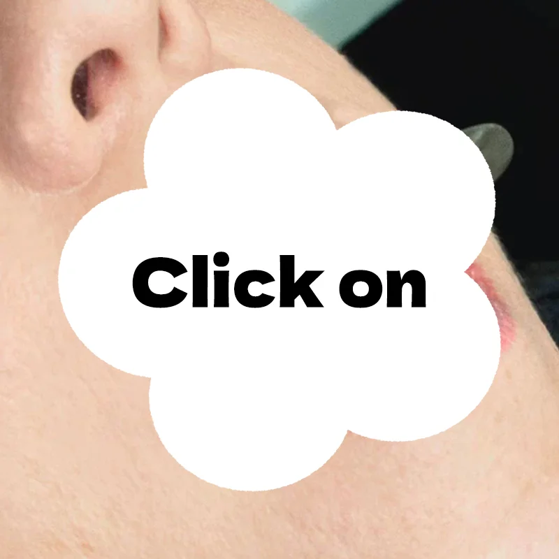 

50pcs/Bag Dental Disposable Suction Tube Holder Tube Saliva Ejector HVE Tube Positioner Autoclavable Dentistry Material