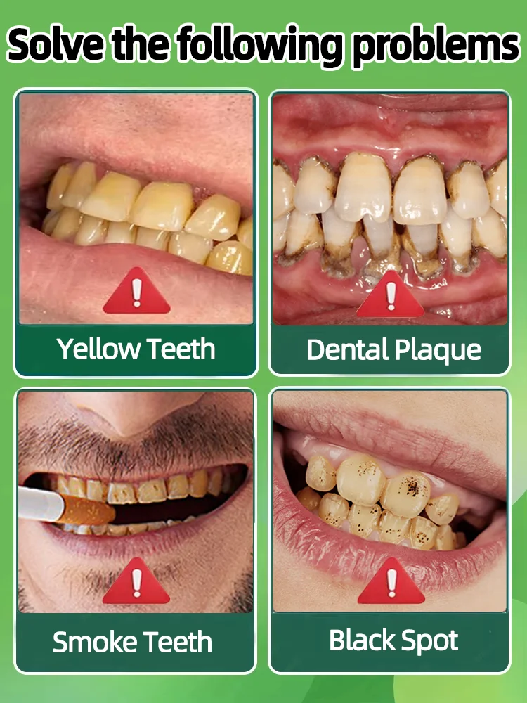 Eliminación de sarro blanqueador dental