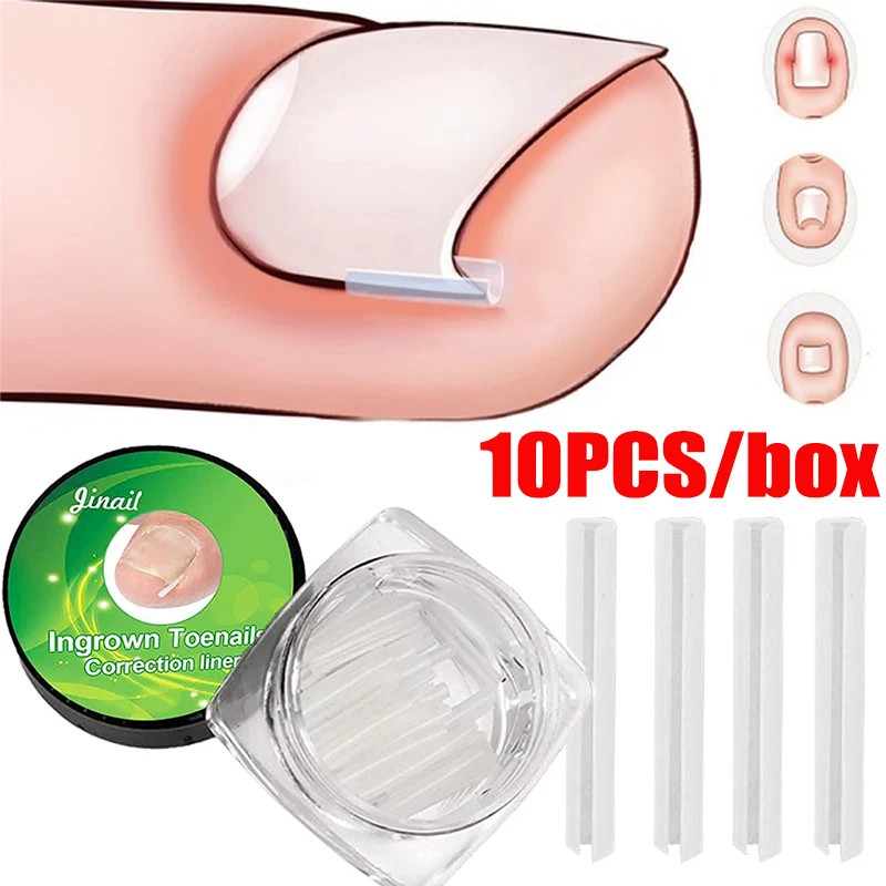 10pcs/box Paronychia Filling Strips Quickly Ingrown Toenail Correction Tool Straightening Toe Nail Treatment Brace Pedicure Tool