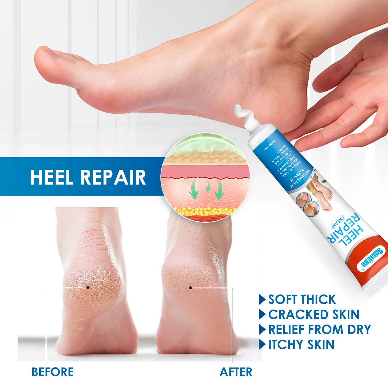ครีมซ่อมแซมส้นเท้า ครีมดูแลเท้า ครีมภายนอกสําหรับมือและเท้าแตก