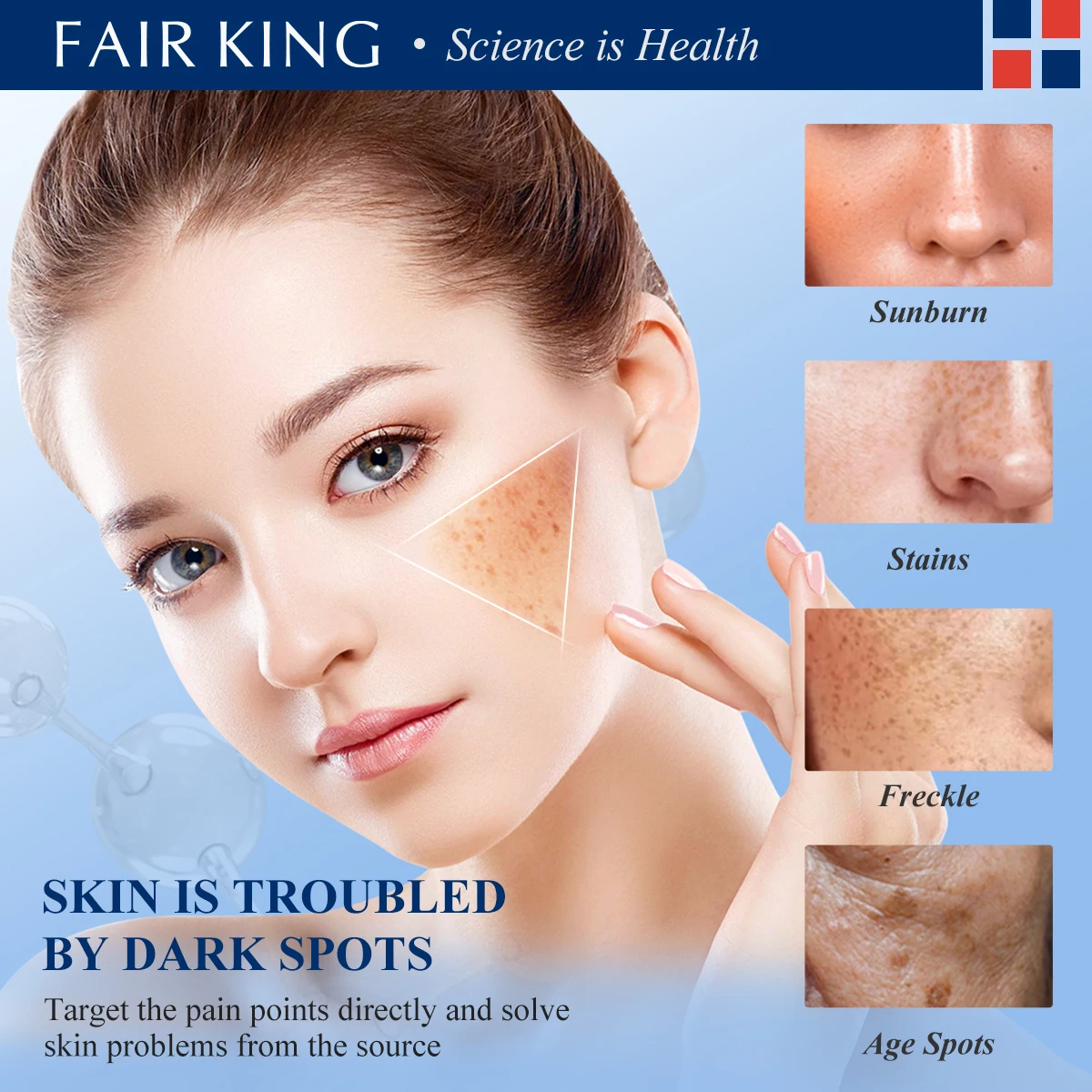 Dark Spot Corrector Skin Whitening Fade Cream Lightening Blemish Removal Serum Reduces Age Spots Freckles Face Cream 20g