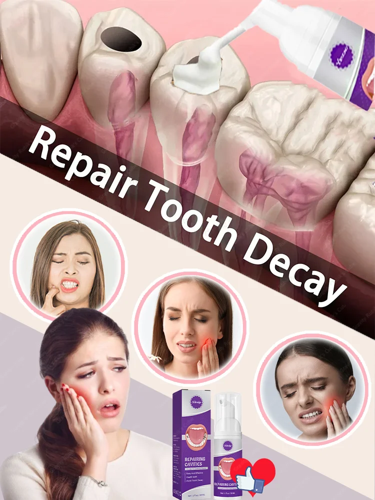 

Anti Decay Toothpaste Prevent Tooth Decay Dental Caries Repair Protect Teeth