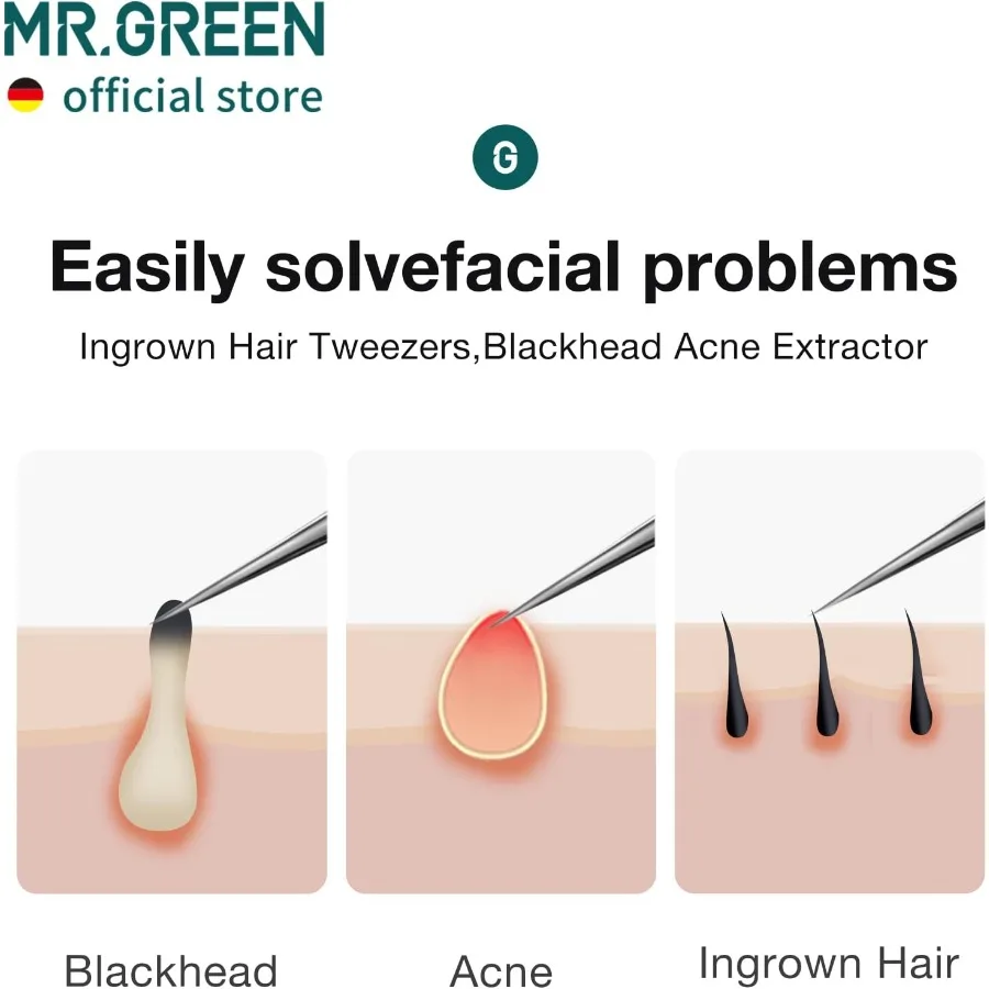 Pinzas para pelo encarnado, aguja para nariz, puntas puntiagudas, pinzas para cejas, espinillas, eliminación negra, Extractor de Clip para acné largo