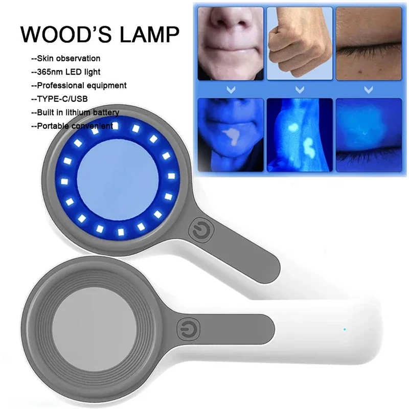 Lampe en bois pour analyseur de peau, lampe ultraviolette UV pour examen de la peau, Test de beauté, grossissement du visage, lampe Vitiligo