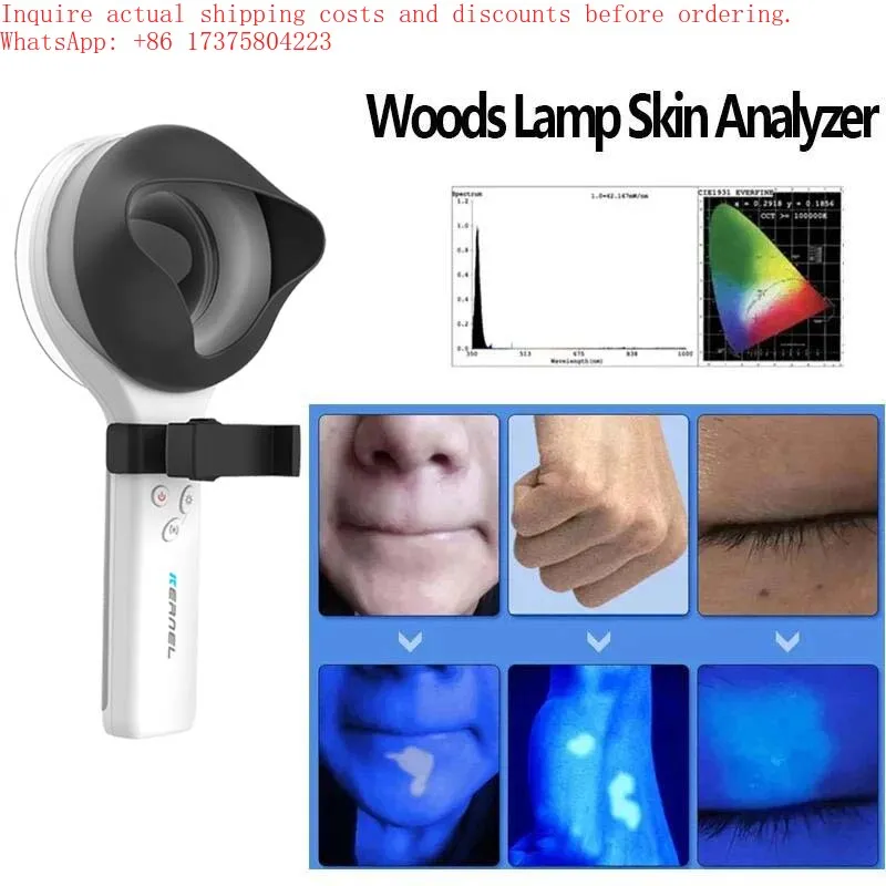 First-Generation UV Scanner Wood Lamp Health Detection Magnify for Face Head Body-EU IT JP US Plug Types