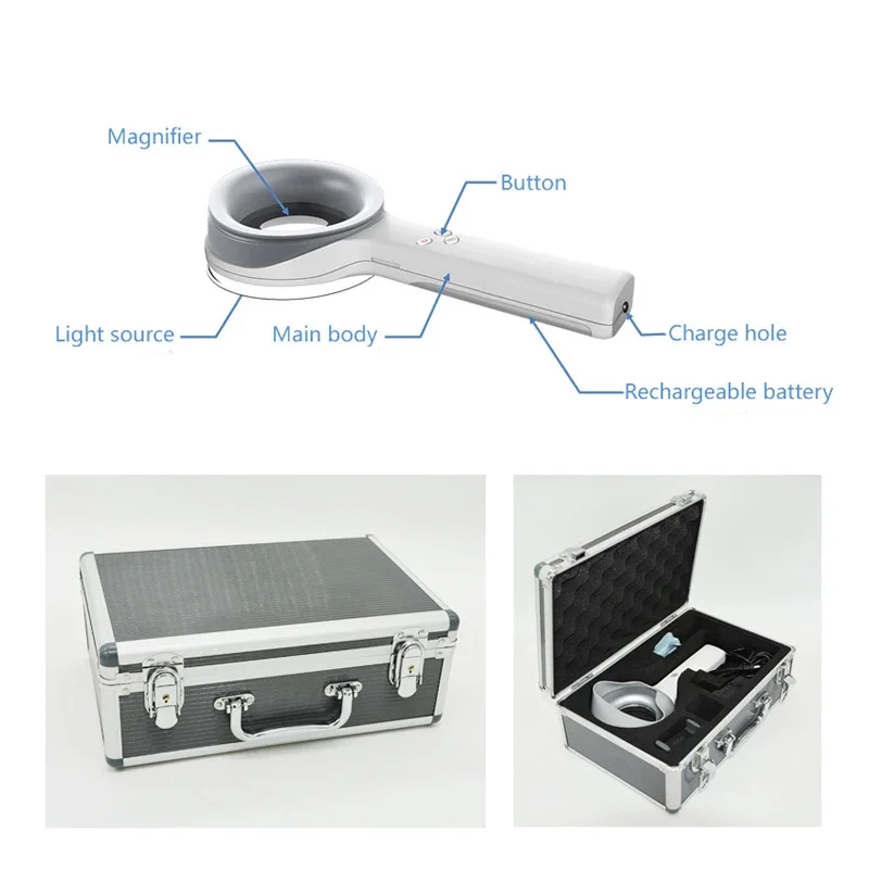 

Portable Dermatology Medical Woods Lamp Dermis Analysis