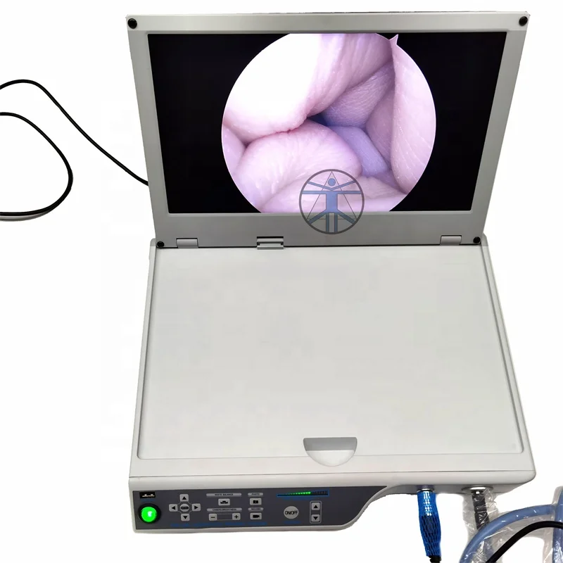 Medical ent nasal endoscope laparoscopic portable endoscope camera transforaminal interlaminar spine endoscope