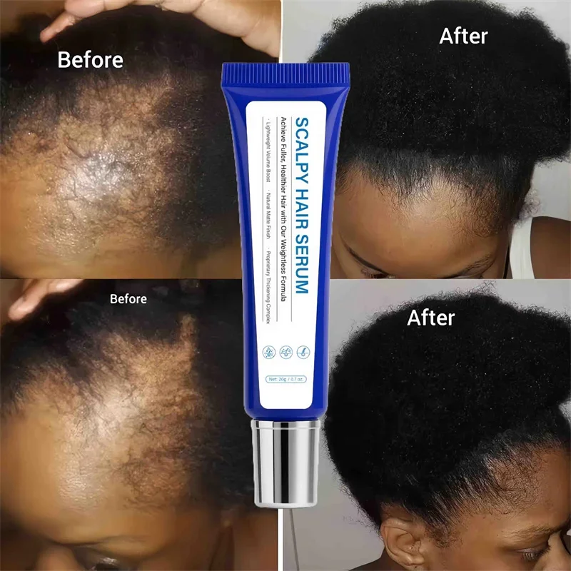 

Fast Hair Growth Serum Hair Regrowth Essential Oil Anti Hair Loss Repair Damaged Scalp Women Men Anti Baldness Hair Growth Care