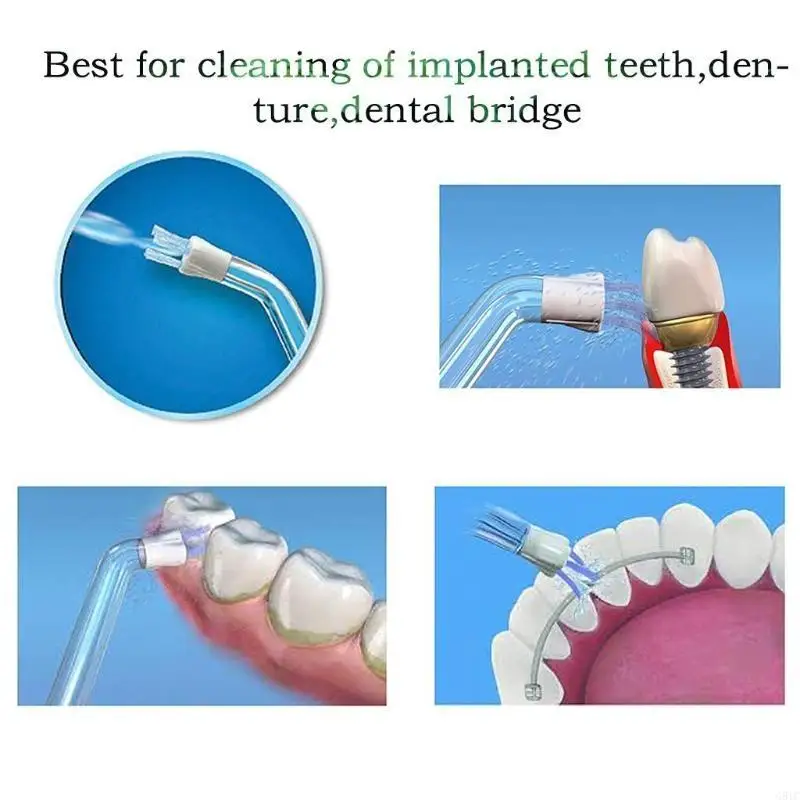 Mẹo tìm kiếm mảng bám G8TC cho nước dùng nước xỉa nước Mẹo Mẹo Tháo các mẹo lông