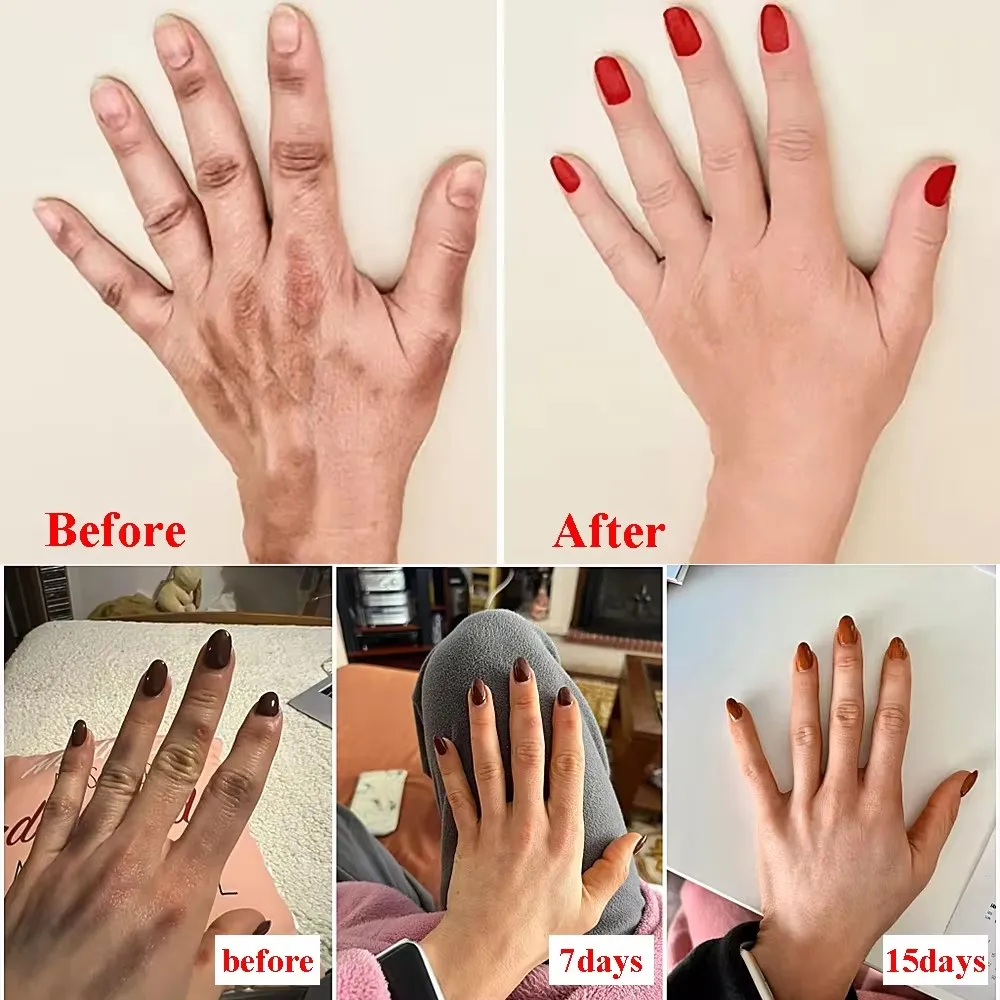 Niacinamide Arbutin Whitening Wrinkle Hand Cream Removal Anti-crack Moisturizing Repair Serum Fade Fine Lines Smooth Skin Care