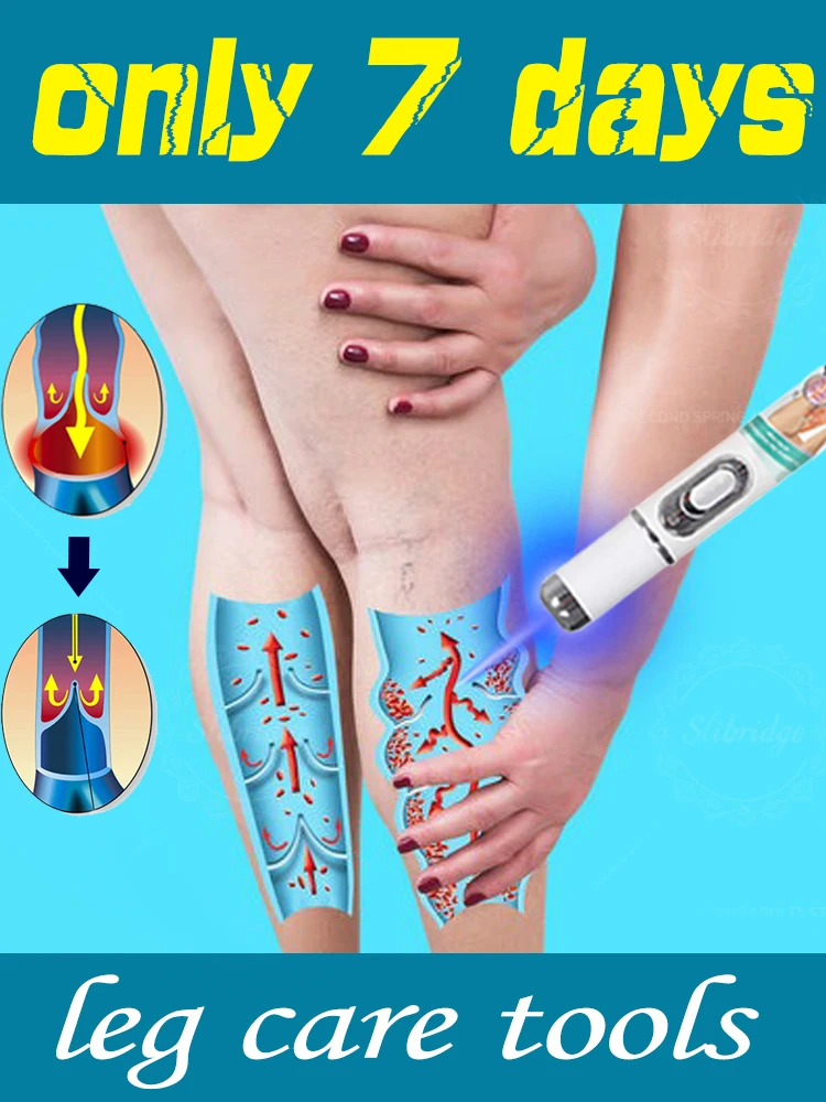 

1pc/2pc/3pc leg care tool, blue light pen, varicose veins