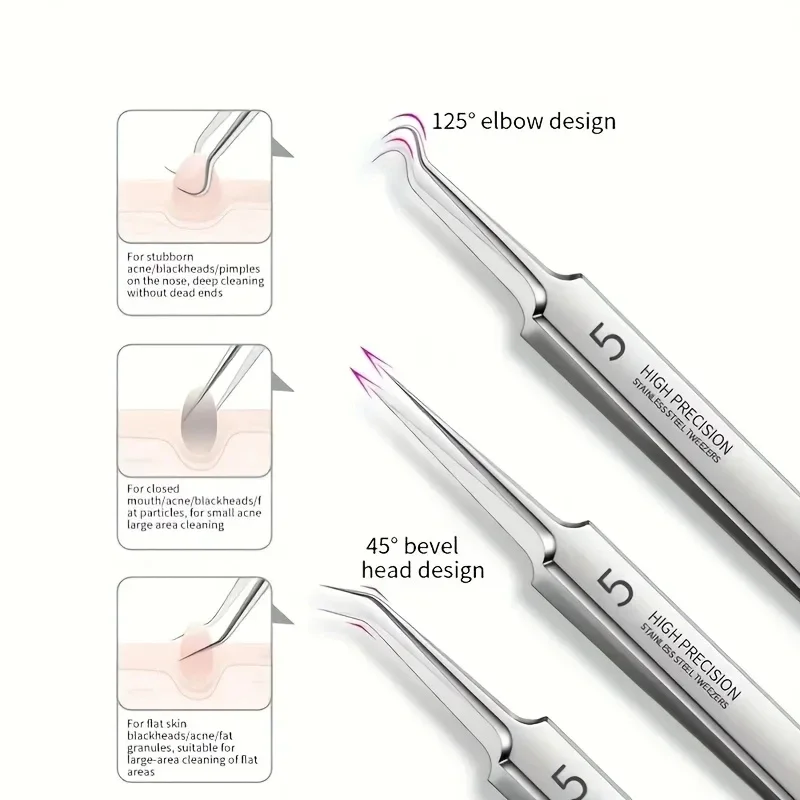 1/3/5/8-teiliges Edelstahl-Mitesserentferner-Set, professionelles Pickelentferner-Set für die Extraktion von Akne und Hautunreinheiten – Detail 4