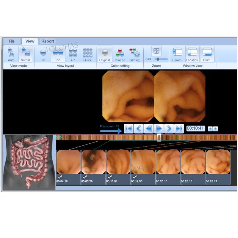 LHPCST1 Diagnosescreeningapparatuur klein formaat Endoscopiesysteem Medic/al-capsule