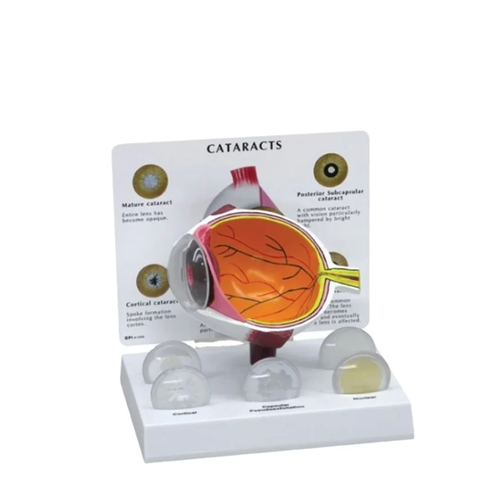 

Увеличенный человеческий медицинский глаз, модель зоараката, модель глаза, анатомическая модель, модель воловкомы