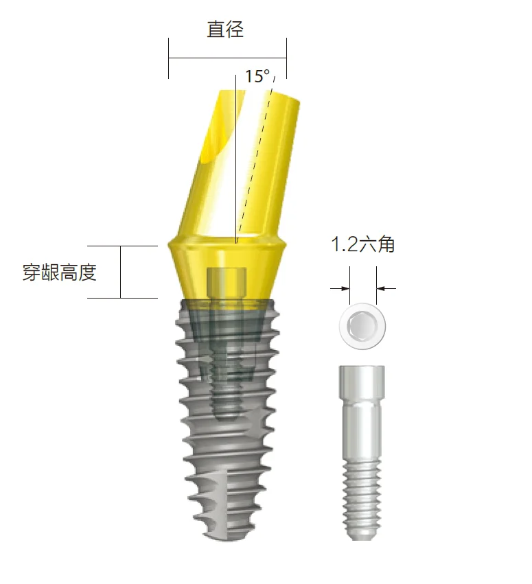 Dental Implant Dentaire Implantes Neo Biotech  Angled Abdubment