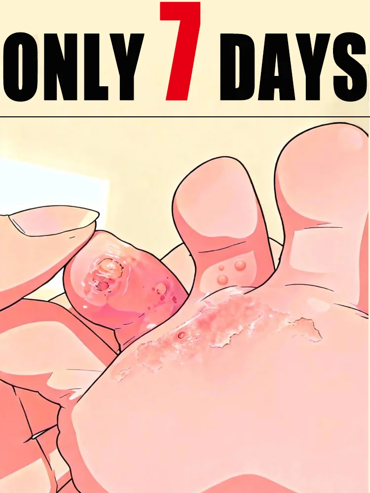 Ontdoen van voetvervelingen, de nieuwste voetverlosser van 2025