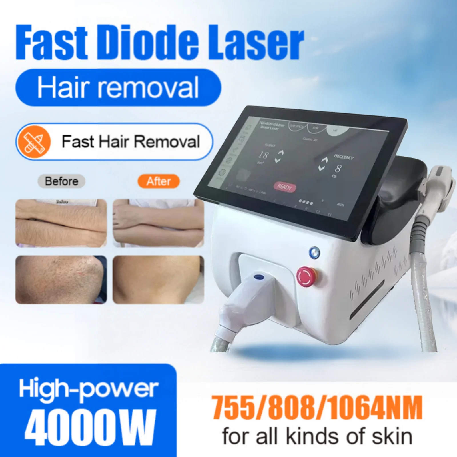 

Professional 755Nm 808Nm 940Nm 1064Nm Epilation Laser Hair Removal Machine 4 Wavelengths 808nm Diode Laser Hair Removal Machine