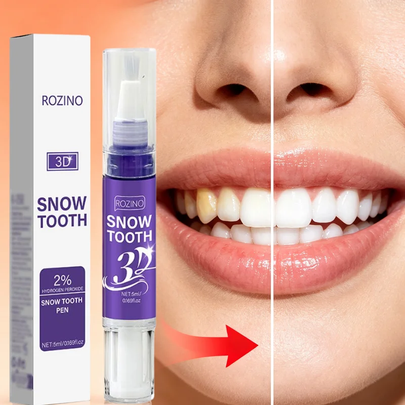 Przenośny długopis do wybielan – Teeth Whitening Pens recenzja i cena