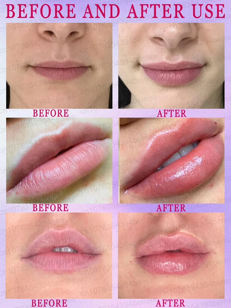Three-dimensional plump lips, a more charming smile, 100% effective